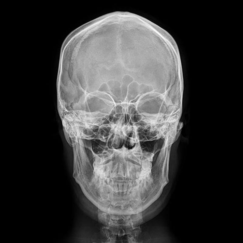 Coogie - 2nd Album [Upset]/Product Detail/World