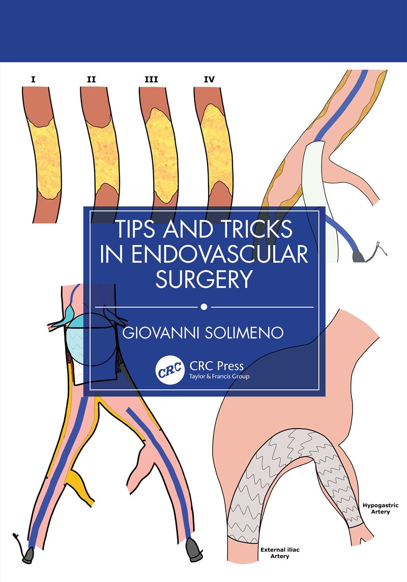 Tips And Tricks In Endovascular Surgery A "How To" Guide For Reaching The Next Level In Endovascular/Product Detail/Healthcare