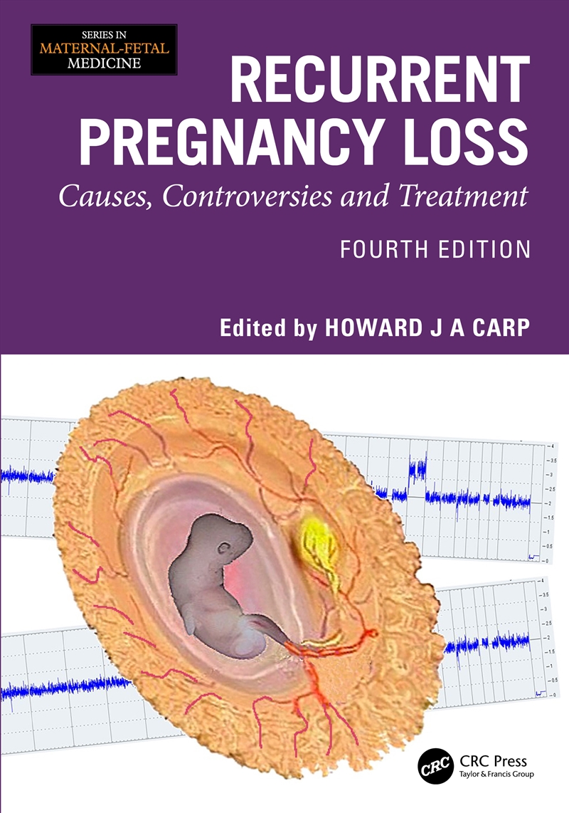 Recurrent Pregnancy Loss Causes, Controversies And Treatment/Product Detail/Healthcare