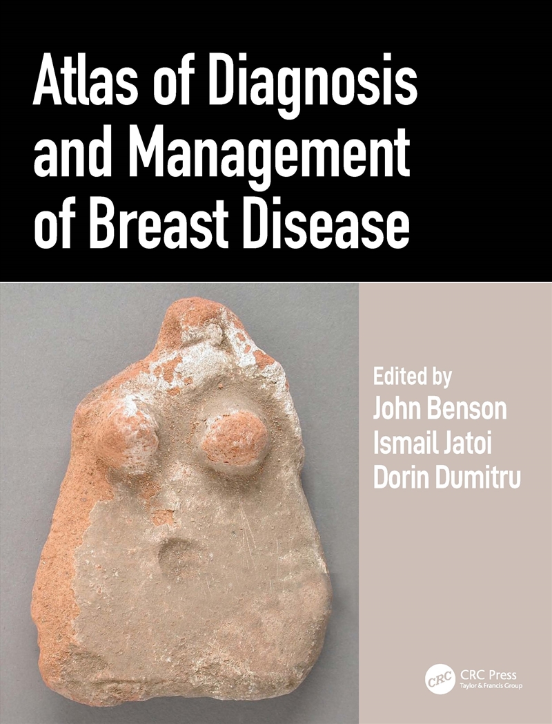 Atlas Of Diagnosis And Management Of Breast Disease/Product Detail/Healthcare