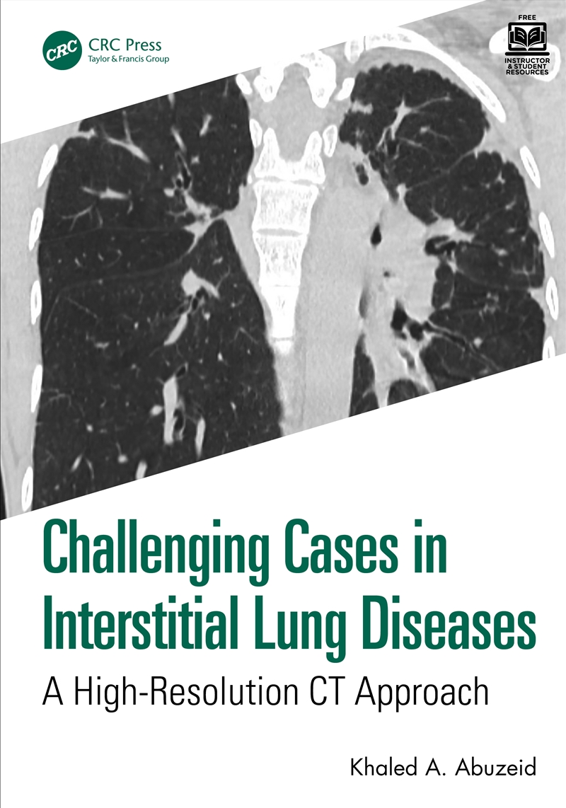 Challenging Cases In Interstitial Lung Diseases A High-Resolution Ct Approach/Product Detail/Healthcare