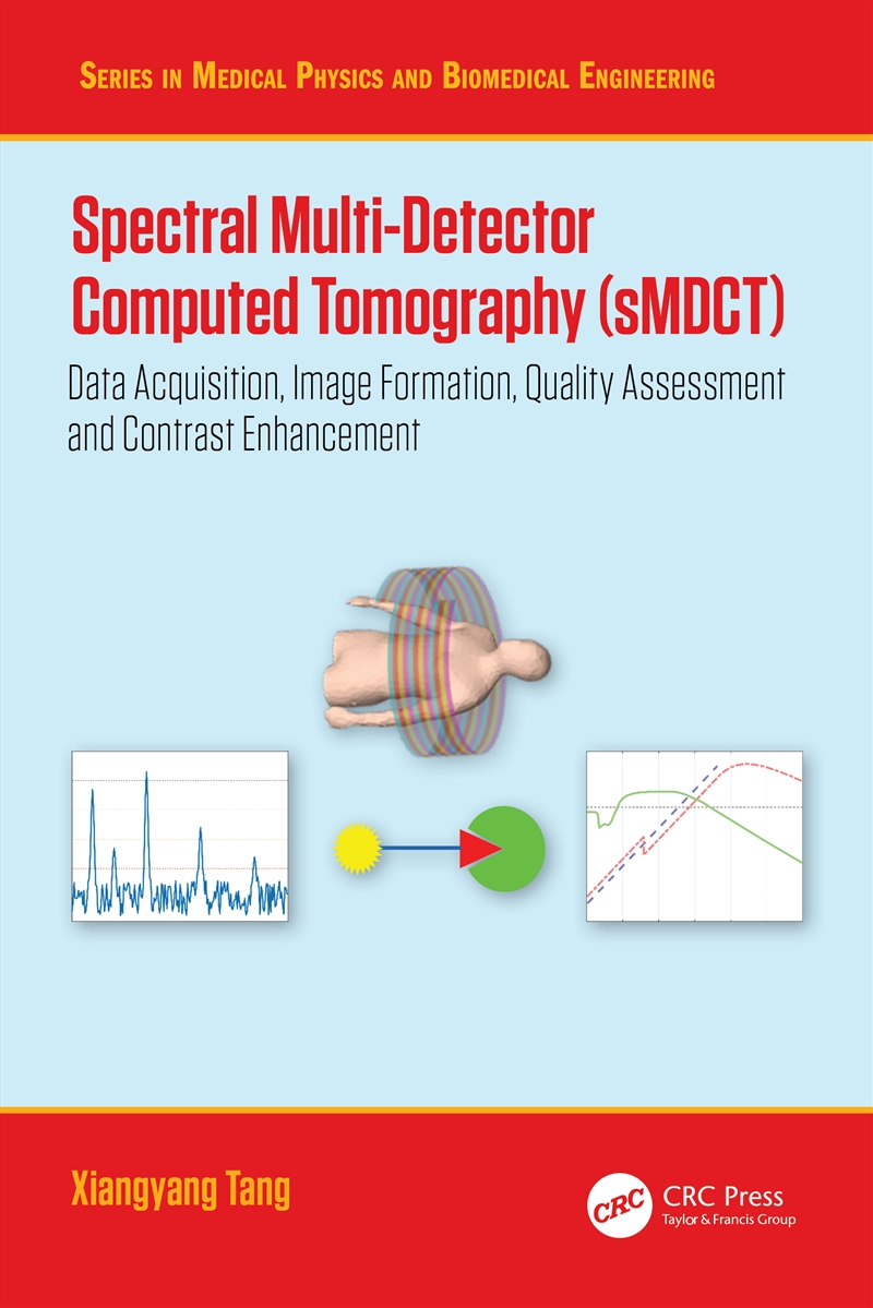 Spectral Multi-Detector Computed Tomography (Smdct) Data Acquisition, Image Formation, Quality Asses/Product Detail/Science