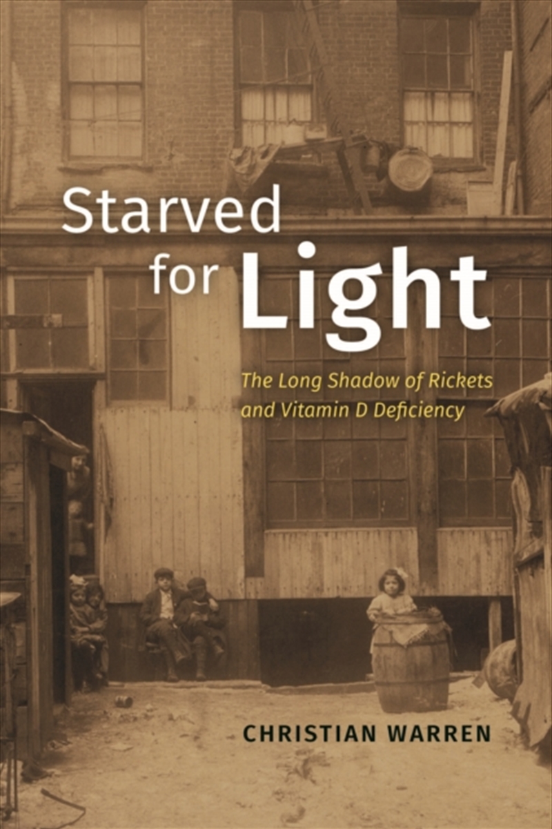 Starved For Light : The Long Shadow Of Rickets And Vitamin D Deficiency/Product Detail/Healthcare