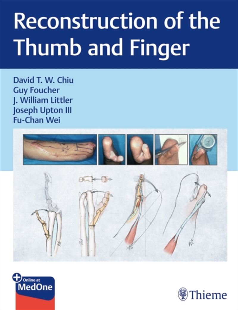 Reconstruction Of The Thumb And Finger/Product Detail/Healthcare