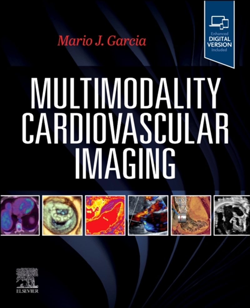 Multimodality Cardiovascular Imaging/Product Detail/Healthcare