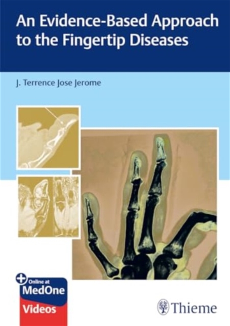 An Evidence-Based Approach To The Fingertip Diseases/Product Detail/Healthcare