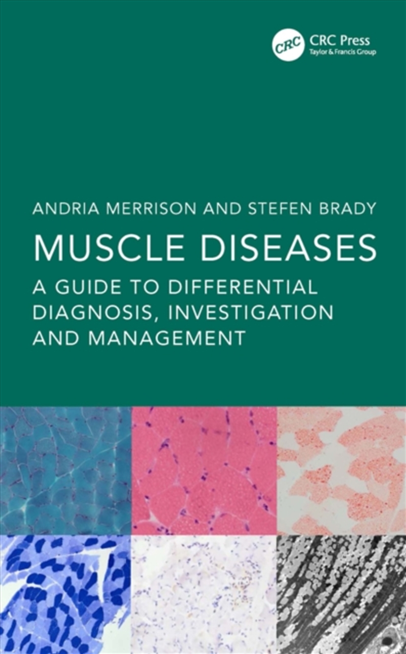 Muscle Diseases : A Guide To Differential Diagnosis, Investigation And Management/Product Detail/Healthcare