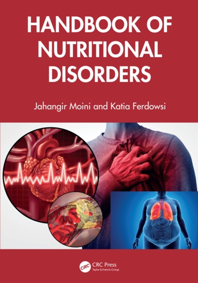 Handbook Of Nutritional Disorders/Product Detail/Fitness, Diet & Weightloss