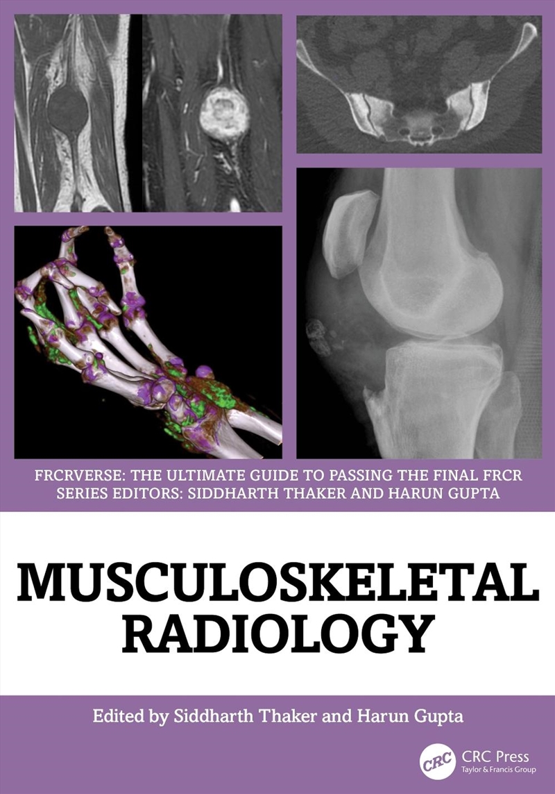 Musculoskeletal Radiology An Ultimate Guide To Passing The Final Frcr/Product Detail/Healthcare