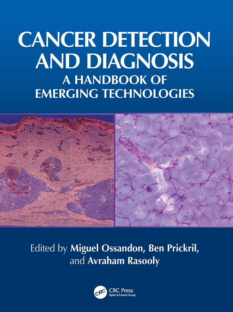 Cancer Detection and Diagnosis/Product Detail/Technology & Engineering