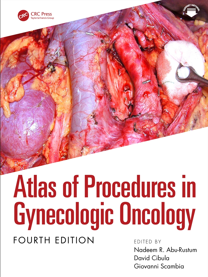 Atlas of Procedures in Gynecologic Oncology/Product Detail/Healthcare