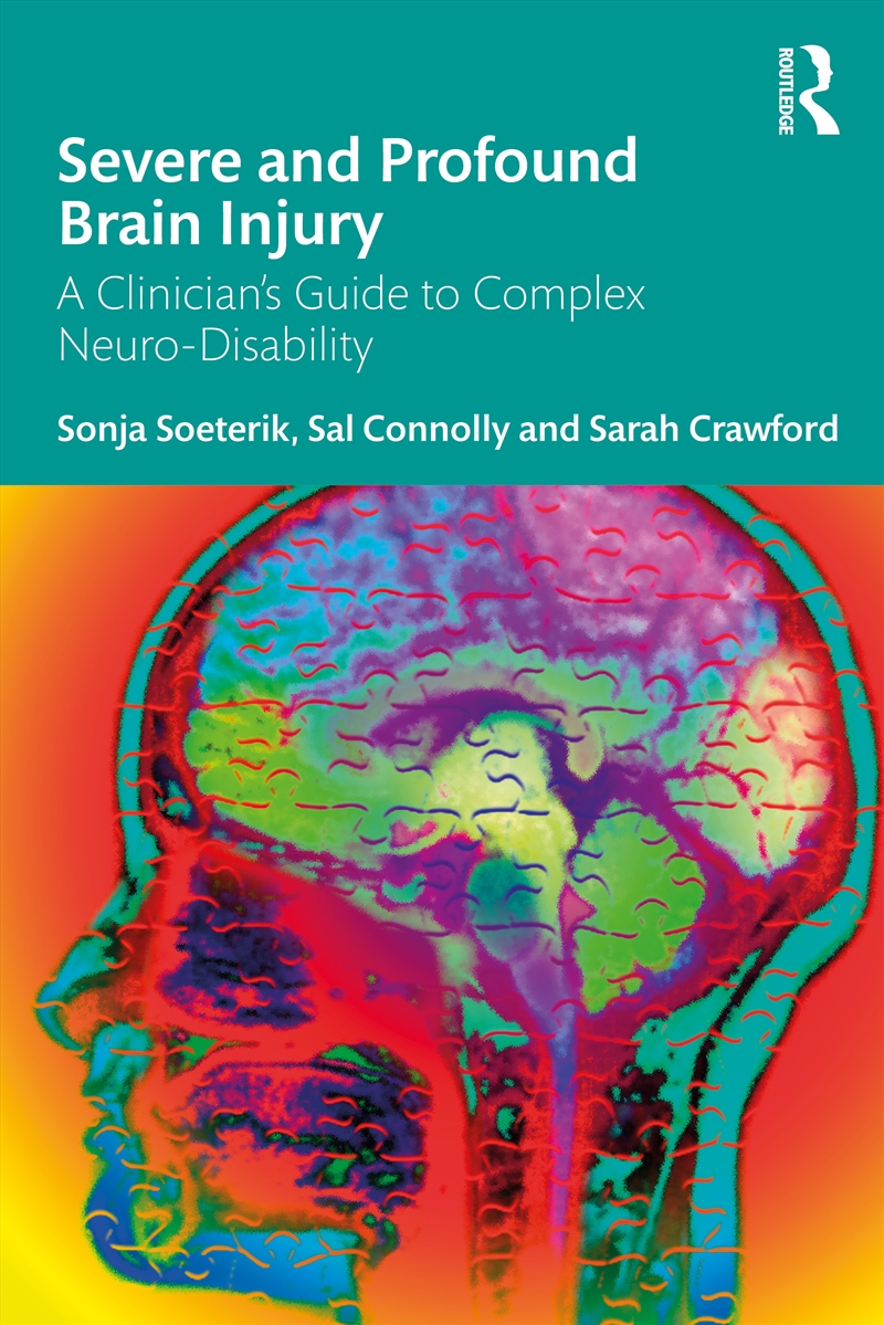 Severe And Profound Brain Injury/Product Detail/Psychology