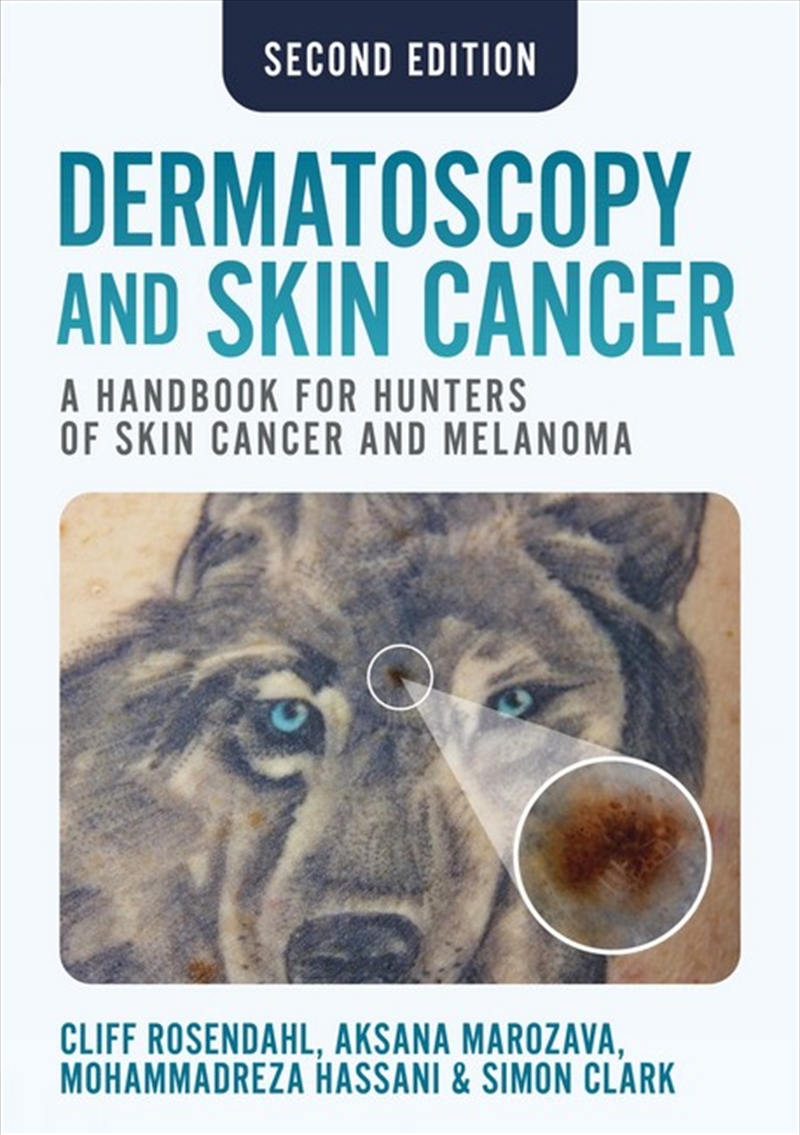 Dermatoscopy and Skin Cancer, second edition/Product Detail/Healthcare