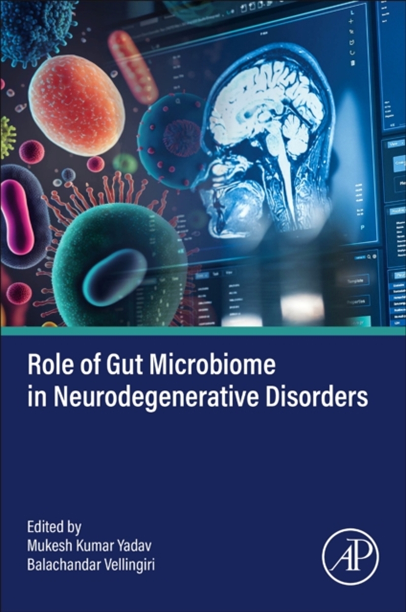 Role Of Gut Microbiome In Neurodegenerative Disorders/Product Detail/Science