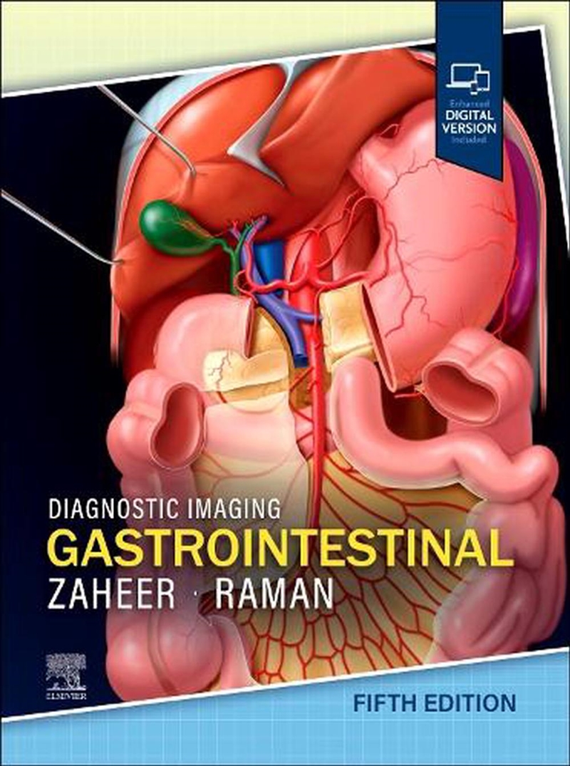 Diagnostic Imaging: Gastrointestinal/Product Detail/Healthcare