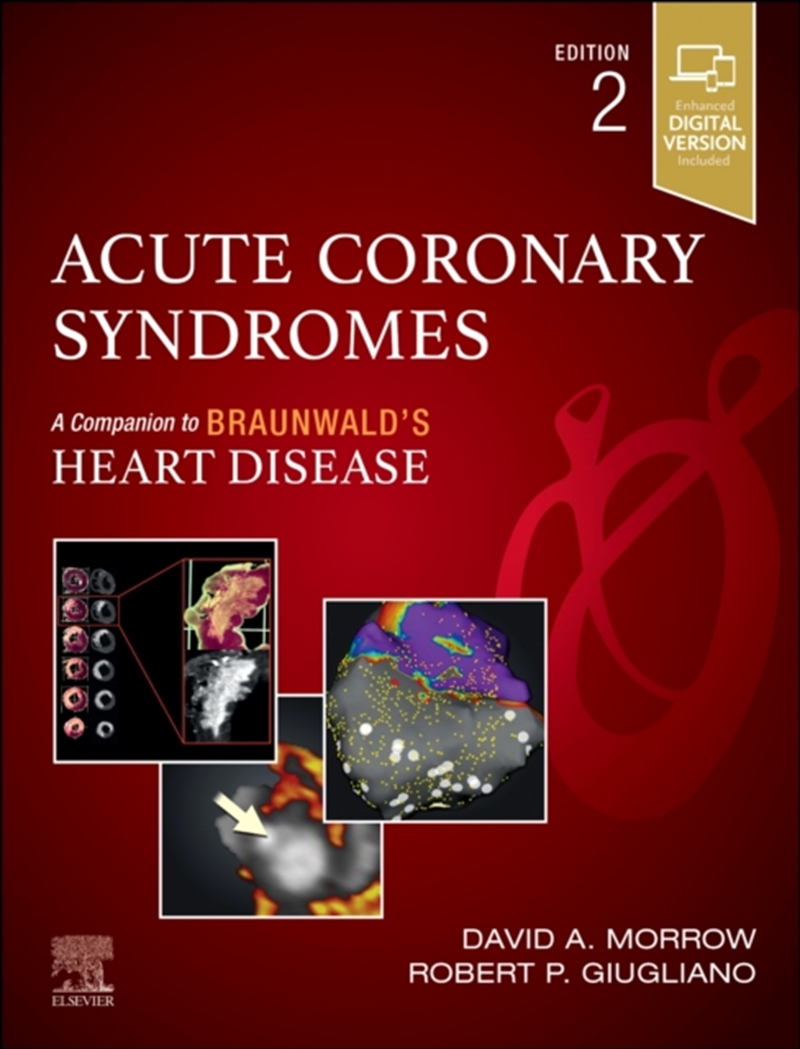 Acute Coronary Syndromes/Product Detail/Healthcare