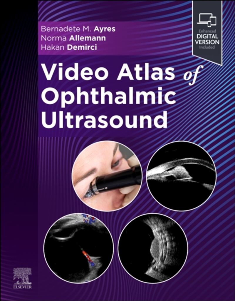 Video Atlas Of Ophthalmic Ultrasound/Product Detail/Healthcare