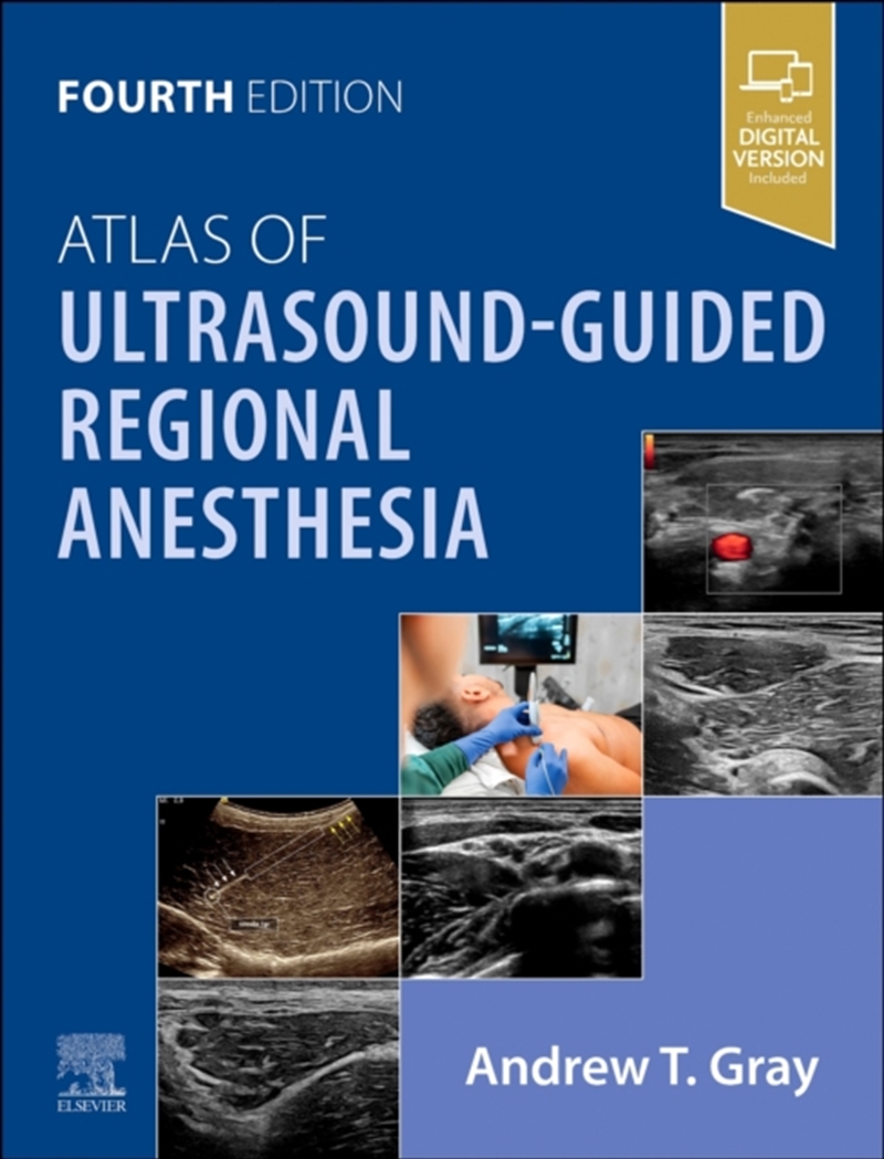 Atlas Of Ultrasound-Guided Regional Anesthesia/Product Detail/Family & Health