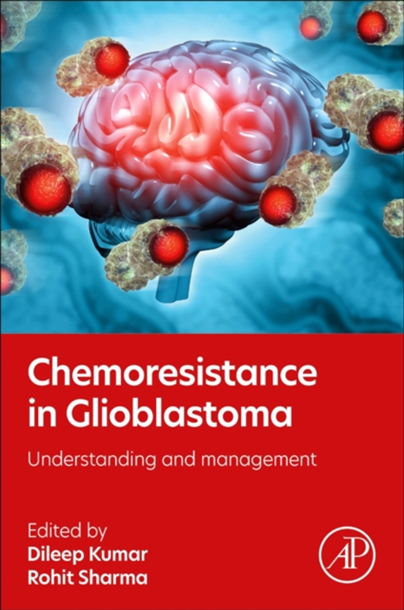 Chemoresistance In Glioblastoma : Understanding And Management/Product Detail/Science