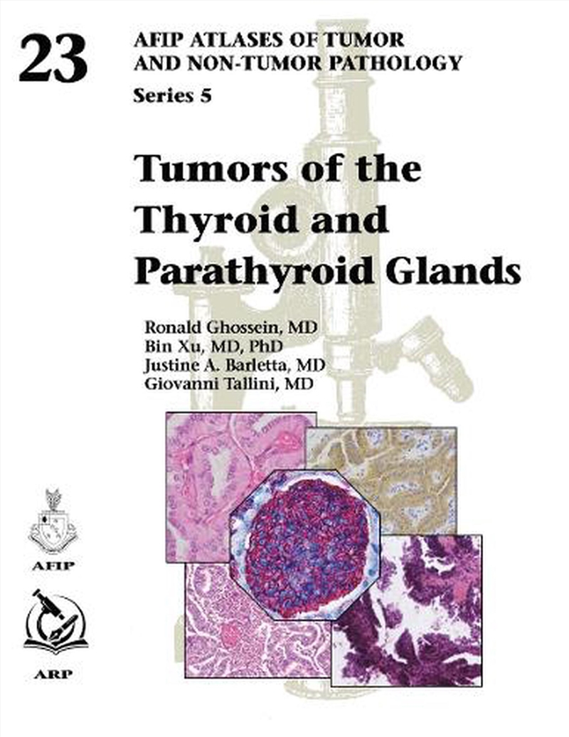 Tumors of the Thyroid and Parathyroid Glands/Product Detail/Healthcare