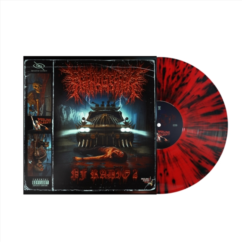 Pf Radio 2/Product Detail/Metal