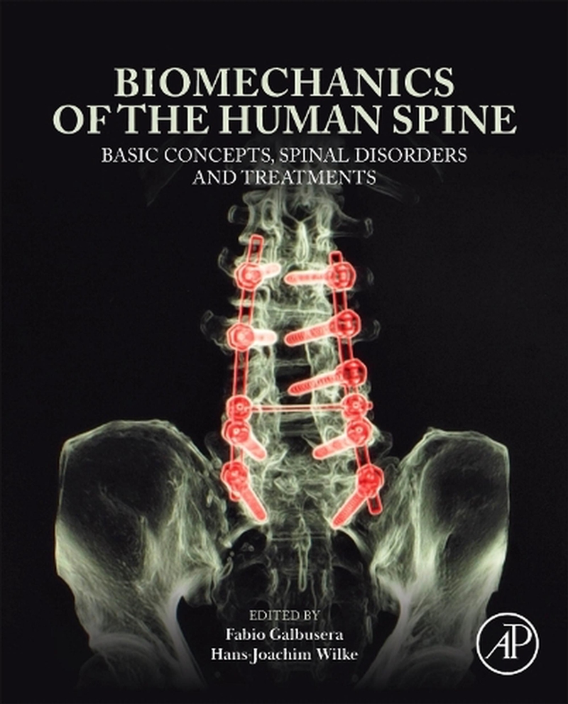 Biomechanics Of The Human Spine : Basic Concepts, Spinal Disorders And Treatments/Product Detail/Science
