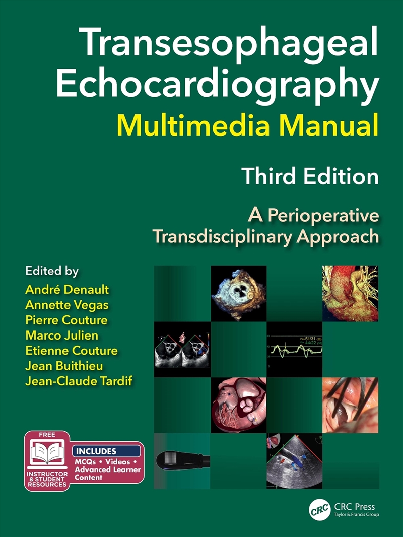 Transesophageal Echocardiography Multimedia Manual/Product Detail/Healthcare