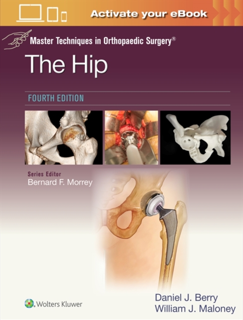 Master Techniques In Orthopaedic Surgery: The Hip: Print + Ebook With Multimedia/Product Detail/Healthcare