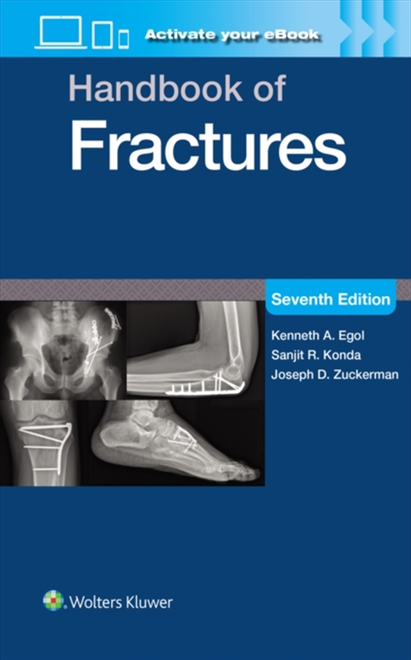 Handbook Of Fractures: Print + Ebook With Multimedia/Product Detail/Healthcare