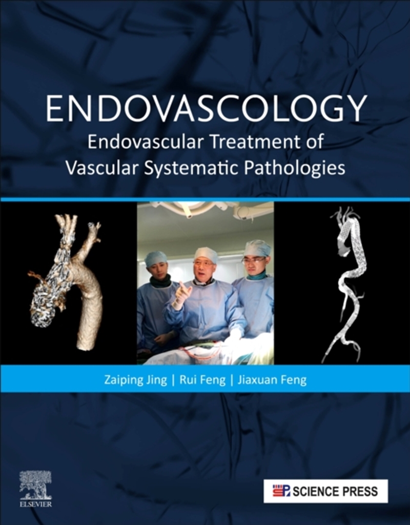Endovascology : Endovascular Treatment Of Vascular Systematic Pathologies/Product Detail/Healthcare