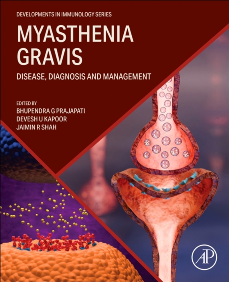 Myasthenia Gravis : Disease, Diagnosis And Management/Product Detail/Healthcare
