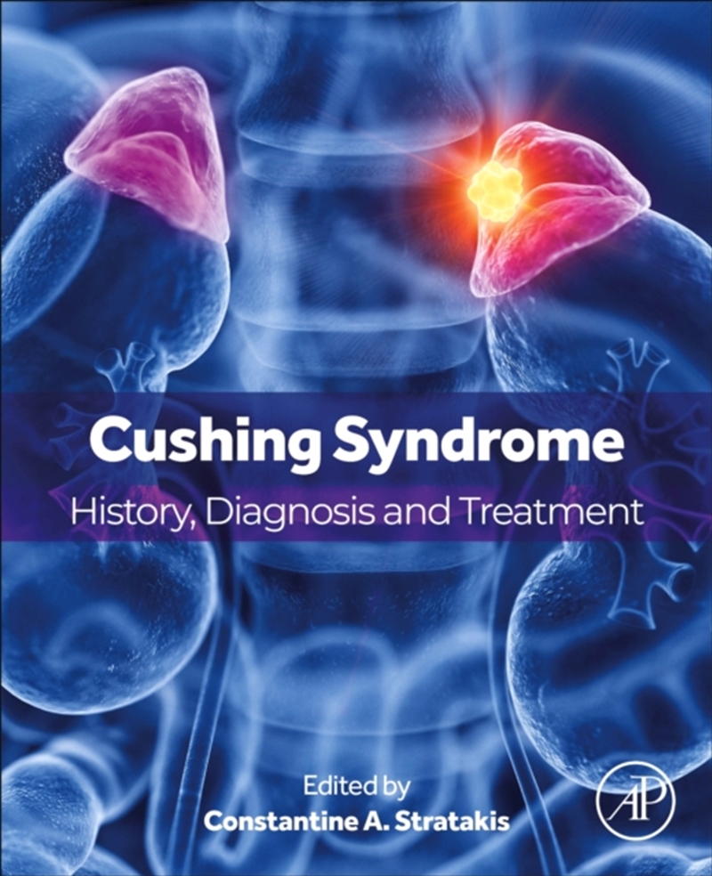 Cushing Syndrome : History, Diagnosis And Treatment/Product Detail/Science
