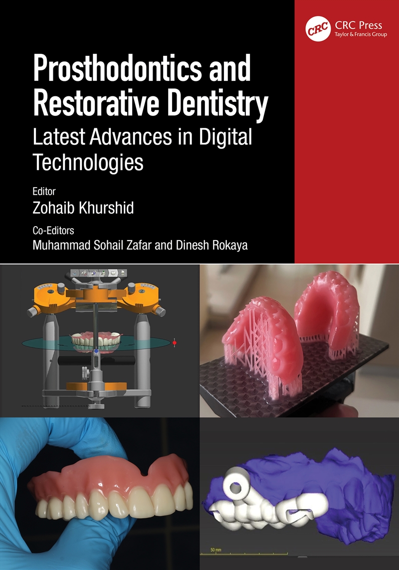 Prosthodontics And Restorative Dentistry/Product Detail/Family & Health