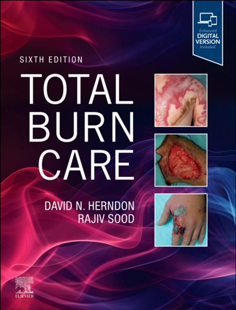 Total Burn Care/Product Detail/Healthcare