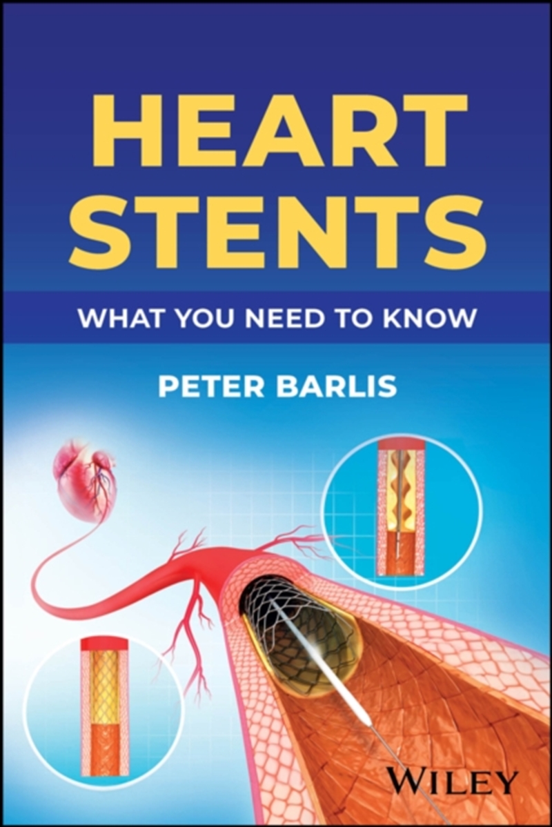 Heart Stents : What You Need To Know/Product Detail/Healthcare