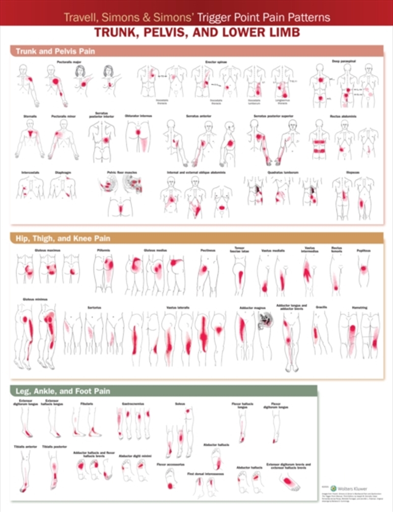 Travell, Simons & Simons’ Trigger Point Pain Patterns Wall Chart : Trunk, Pelvis, And Lower Limb/Product Detail/Healthcare