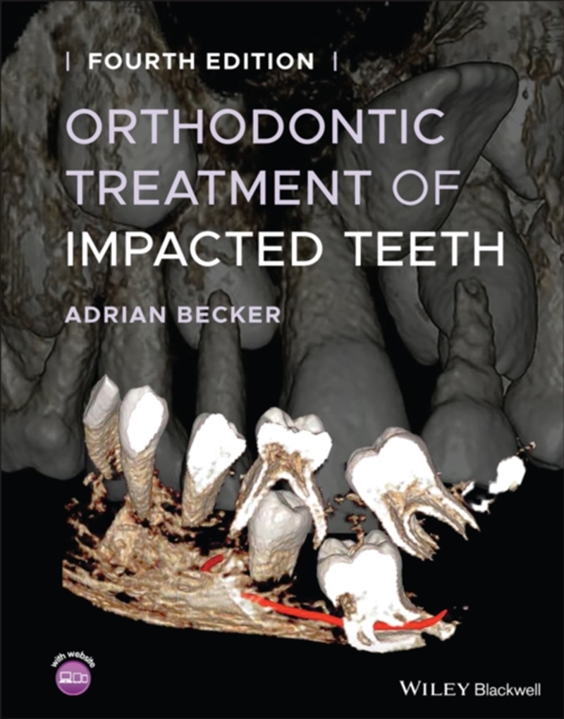 Orthodontic Treatment Of Impacted Teeth/Product Detail/Healthcare