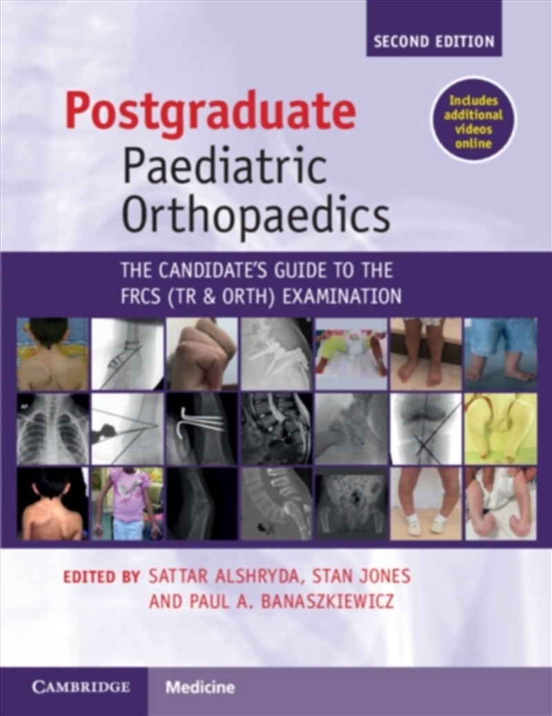 Postgraduate Paediatric Orthopaedics/Product Detail/Healthcare