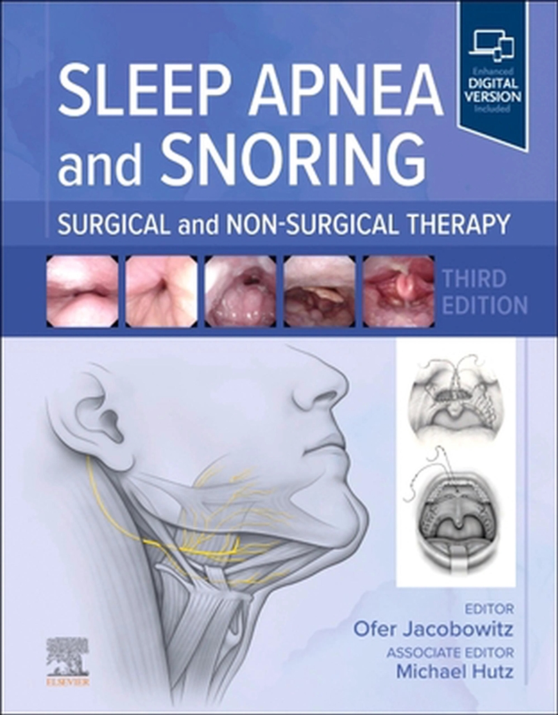 Sleep Apnea And Snoring : Surgical And Non-Surgical Therapy/Product Detail/Healthcare