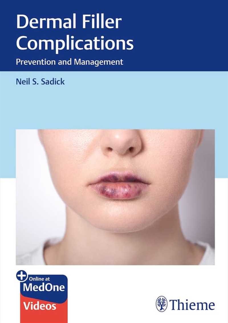 Dermal Filler Complications : Prevention And Management/Product Detail/Healthcare