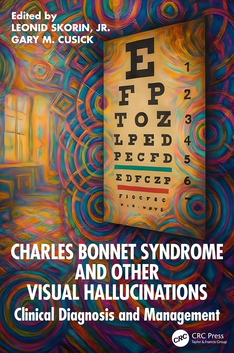Charles Bonnet Syndrome And Other Visual Hallucinations/Product Detail/Healthcare