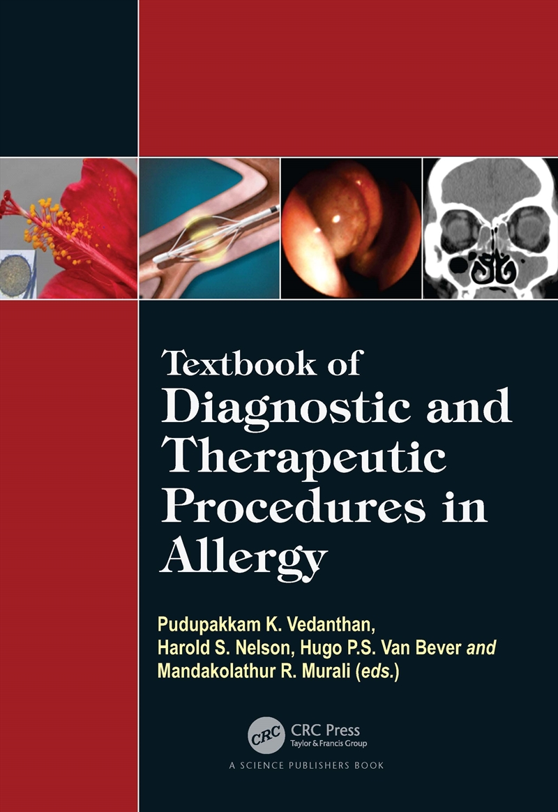 Textbook Of Diagnostic And Therapeutic Procedures In Allergy/Product Detail/Healthcare