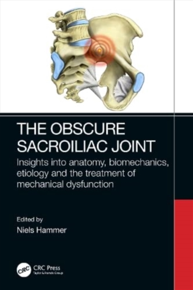 Obscure Sacroiliac Joint/Product Detail/Healthcare