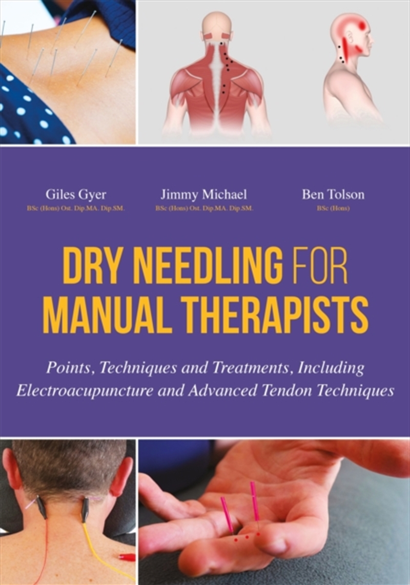 Dry Needling For Manual Therap/Product Detail/Science