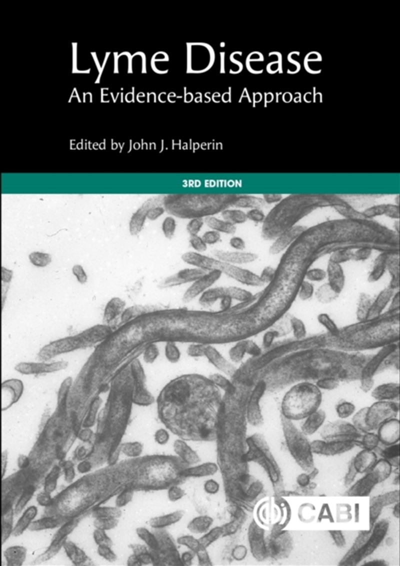Lyme Disease : An Evidence-Based Approach/Product Detail/Science