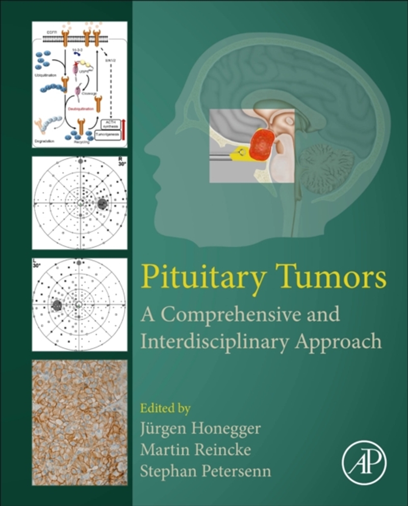 Pituitary Tumors : A Comprehensive And Interdisciplinary Approach/Product Detail/Science