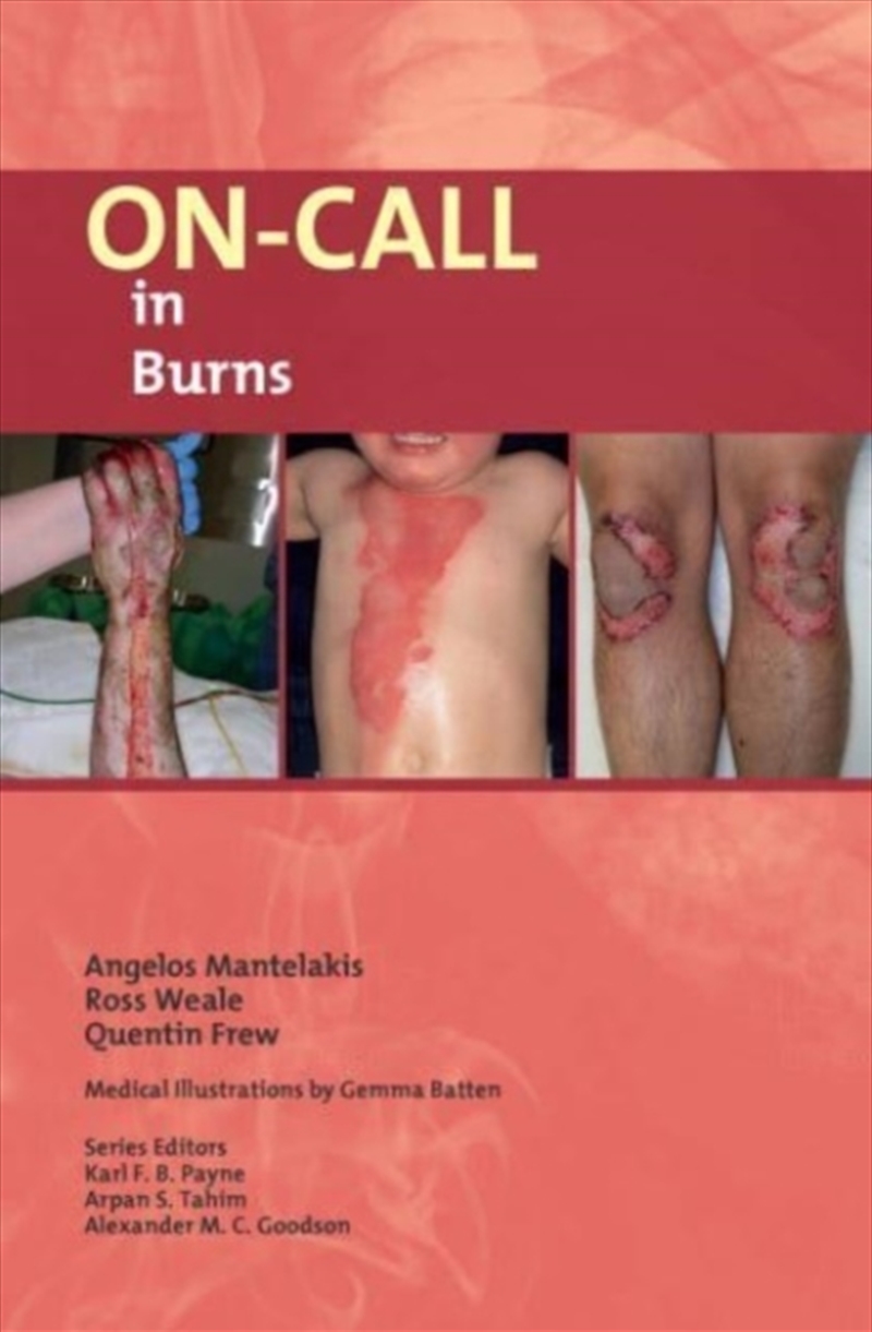 On-Call In Burns/Product Detail/Healthcare