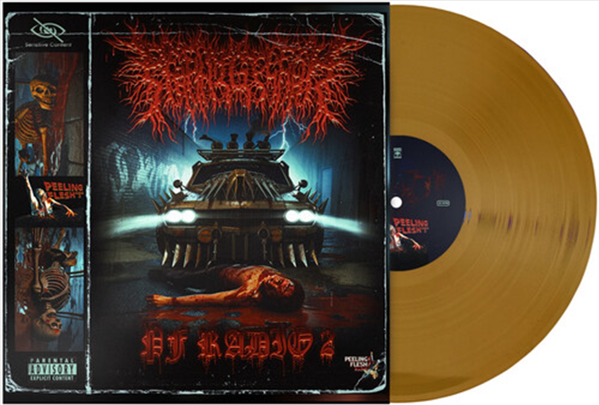 Pf Radio 2/Product Detail/Metal