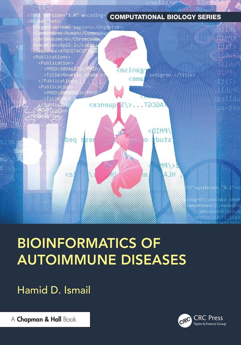 Bioinformatics of Autoimmune Diseases/Product Detail/Science