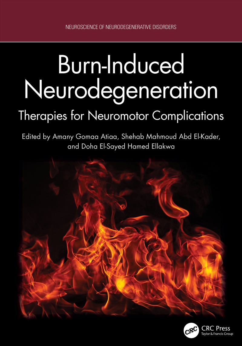Burn-Induced Neurodegeneration/Product Detail/Healthcare